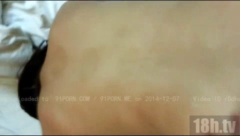 推销医疗器械的骚妞