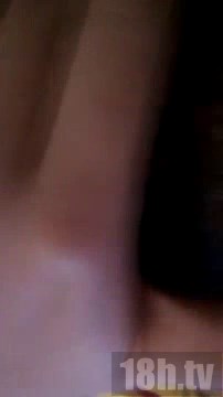 18岁的痘痘女